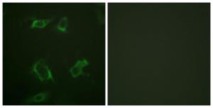 Antibody anti-PLD1 phospho SER561 100 µg