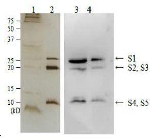 Anti-Pertussis Toxin Antibody