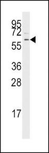 Anti-TGFBR1 Rabbit Polyclonal Antibody (PE (Phycoerythrin))