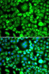 Immunofluorescence analysis of MCF-7 cells using Anti-BLID Antibody (A10097). DAPI was used to stain the cell nuclei (blue).