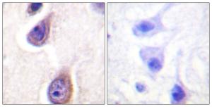 Antibody anti-PLD1 phospho SER561 100 µg