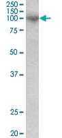 Anti-ADAM8 Goat Polyclonal Antibody