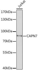 Western blot analysis of extracts of Jurkat cells, using Anti-CAPN7 Antibody (A308419) at 1:1,000 dilution The secondary antibody was Goat Anti-Rabbit IgG H&L Antibody (HRP) at 1:10,000 dilution Lysates/proteins were present at 25 µg per lane