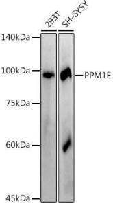 Western blot analysis of extracts of various cell lines, using Anti-PPM1E Antibody [ARC2763] (A305797) at 1:1,000 dilution The secondary antibody was Goat Anti-Rabbit IgG H&L Antibody (HRP) at 1:10,000 dilution Lysates/proteins were present at 25 µg per lane