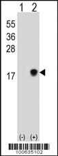 Anti-SUMO2/3 Rabbit Polyclonal Antibody