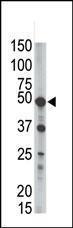 Anti-PIGK Rabbit Polyclonal Antibody (HRP (Horseradish Peroxidase))