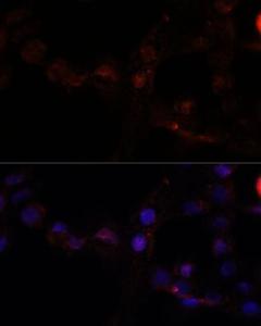 Immunofluorescence analysis of A431 cells using Anti-CAPN7 Antibody (A308419) at a dilution of 1:100 DAPI was used to stain the cell nuclei (blue)