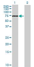 Anti-PGM2 Mouse Polyclonal Antibody