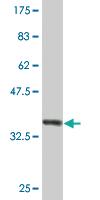 Anti-A2M Mouse Monoclonal Antibody [clone: 2B5]