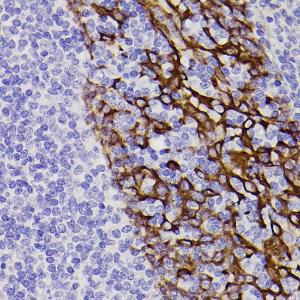 Immunohistochemistry analysis of paraffin-embedded human tonsil using Anti-Cytokeratin 5 Antibody [ARC0585] (A80808) at a dilution of 1:100 (40x lens) Perform microwave antigen retrieval with 10 mM PBS buffer pH 72 before commencing with IHC staining protocol