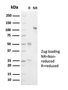 SDS-PAGE analysis of Anti-ALK Antibody [ALK1/7008R] under non-reduced and reduced conditions; showing intact IgG and intact heavy and light chains, respectively. SDS-PAGE analysis confirms the integrity and purity of the antibody