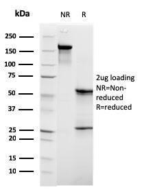 SDS-PAGE analysis of Anti-C1QB Antibody [C1QB/2961] under non-reduced and reduced conditions; showing intact IgG and intact heavy and light chains, respectively. SDS-PAGE analysis confirms the integrity and purity of the antibody