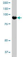 Anti-ADAM8 Goat Polyclonal Antibody