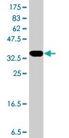 Anti-TP53AIP1 Mouse Polyclonal Antibody