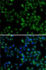 Immunofluorescence analysis of A-549 cells using Anti-DUSP22 Antibody (A10098). DAPI was used to stain the cell nuclei (blue)