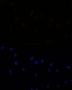 Immunofluorescence analysis of L929 cells using Anti-CAPN7 Antibody (A308419) at a dilution of 1:100 DAPI was used to stain the cell nuclei (blue)