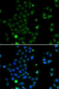 Immunofluorescence analysis of MCF-7 cells using Anti-GCM1 Antibody (A10099). DAPI was used to stain the cell nuclei (blue).