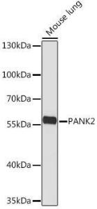 Western blot analysis of extracts of Mouse lung, using Anti-PANK2 Antibody (A308420) at 1:1000 dilution