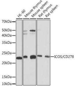 Western blot analysis of extracts of various cell lines, using Anti-ICOS Antibody [ARC1148] (A307475) at 1:1000 dilution