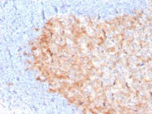 Immunohistochemical analysis of formalin-fixed, paraffin-embedded human tonsil using Anti-CD86 Antibody [C86/3713]