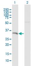 Anti-SRSF7 Mouse Polyclonal Antibody