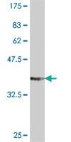 Anti-ARHGEF2 Mouse Polyclonal Antibody