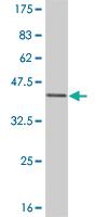 Anti-ESR2 Mouse Monoclonal Antibody [clone: 3F3]