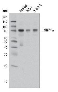 Anti-Hepatocyte Nuclear Factor 1 Alpha Rabbit Polyclonal Antibody