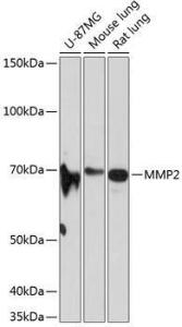 Western blot analysis of extracts of various cell lines, using Anti-MMP2 Antibody [ARC0432] (A308421) at 1:1,000 dilution