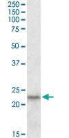 Anti-IL18 Goat Polyclonal Antibody