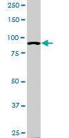 Anti-ACTN4 Mouse Monoclonal Antibody [clone: 4D10]