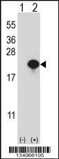 Anti-CYB5A Rabbit Polyclonal Antibody (HRP (Horseradish Peroxidase))