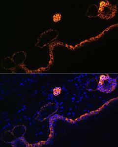 Immunofluorescence analysis of rat skin using Anti-Cytokeratin 5 Antibody [ARC0585] (A80808) at a dilution of 1:100 (40x lens) DAPI was used to stain the cell nuclei (blue)