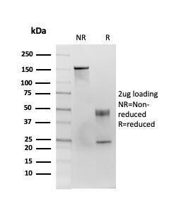 SDS-PAGE analysis of Anti-CD86 Antibody [C86/3713] under non-reduced and reduced conditions; showing intact IgG and intact heavy and light chains, respectively. SDS-PAGE analysis confirms the integrity and purity of the antibody.