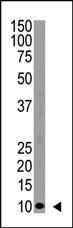 Anti-UB Rabbit Polyclonal Antibody