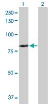 Anti-LIMK2 Rabbit Polyclonal Antibody