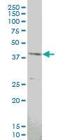 Anti-MAPKAPK3 Mouse Monoclonal Antibody [clone: 4B11]