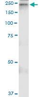 Anti-A2M Polyclonal Antibody Pair