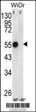 Anti-ATP5B Rabbit Polyclonal Antibody (Biotin)