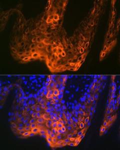 Immunofluorescence analysis of human skin using Anti-Cytokeratin 5 Antibody [ARC0585] (A80808) at a dilution of 1:100 (40x lens) DAPI was used to stain the cell nuclei (blue)