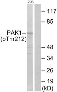 Western blot analysis of lysates from 293 cells treated with etoposide 25 µM 1 h using Anti-PAK1 (phospho Thr212) Antibody. The right hand lane represents a negative control, where the Antibody is blocked by the immunising peptide