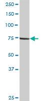 Anti-LIMK2 Rabbit Polyclonal Antibody