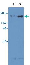 Anti-EGFR Mouse Monoclonal Antibody [clone: EM-12]