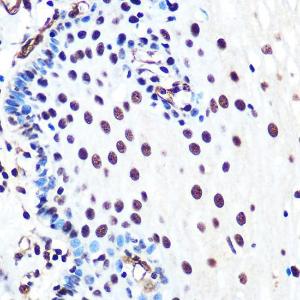 Immunohistochemistry analysis of paraffin-embedded human esophageal using Anti-Ku80 Antibody [ARC0706] (A307476) at a dilution of 1:100 (40X lens). Perform microwave antigen retrieval with 10 mM PBS buffer pH 7.2 before commencing with IHC staining protocol