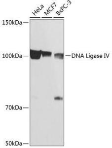 Western blot analysis of extracts of various cell lines, using Anti-DNA Ligase IV / LIG4 Antibody [ARC0595] (A80811) at 1:1,000 dilution. The secondary antibody was Goat Anti-Rabbit IgG H&L Antibody (HRP) at 1:10,000 dilution.