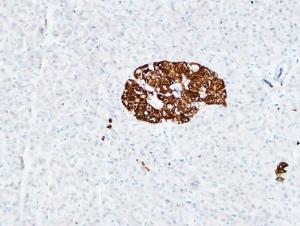 Anti-CD133 Rabbit Polyclonal Antibody