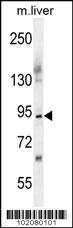 Anti-ST14 Rabbit Polyclonal Antibody