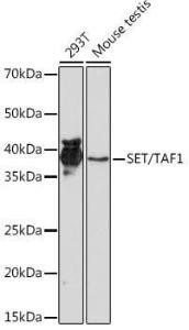 Western blot analysis of extracts of various cell lines, using Anti-SET/TAF-I Antibody [ARC1462] (A305799) at 1:1,000 dilution