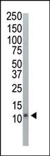 Anti-UB Rabbit Polyclonal Antibody