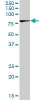 Anti-LIMK2 Rabbit Polyclonal Antibody